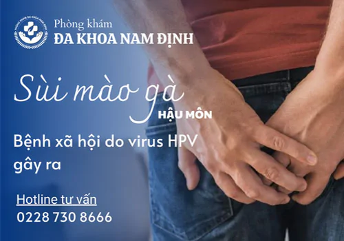 Tổng quan sùi mào gà hậu môn: Nguyên nhân, dấu hiệu và biện pháp loại bỏ mụn sùi
