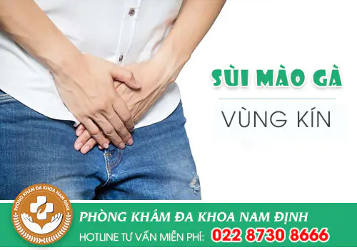Sùi mào gà vùng kín và những điều bạn cần biết