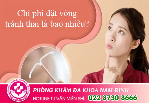 Chi phí đặt vòng tránh thai là bao nhiêu?