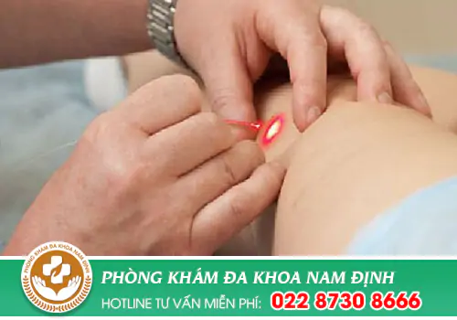Tại Nam Định đốt sùi mào gà ở đâu tốt?