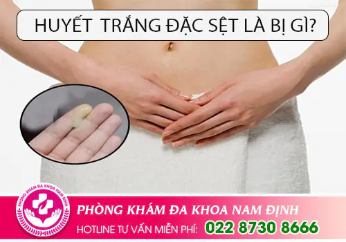 Huyết trắng đặc sệt là bị gì?
