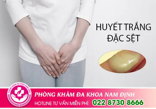 Hiện tượng huyết trắng đặc sệt là bị gì ?