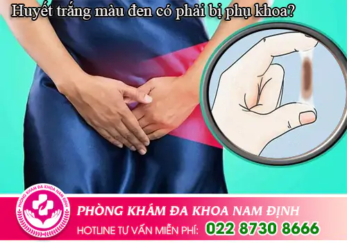 Huyết trắng màu đen có phải bị phụ khoa?