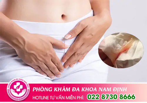 Huyết trắng ra nhiều và có máu