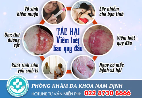 tác hại viêm loét bao quy đầu