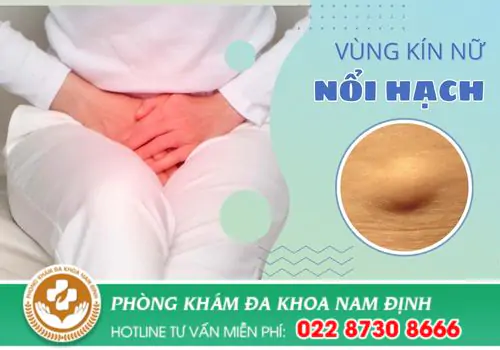 Nguyên Nhân Vùng Kín Nổi Hạch Ở Nữ Là Gì?