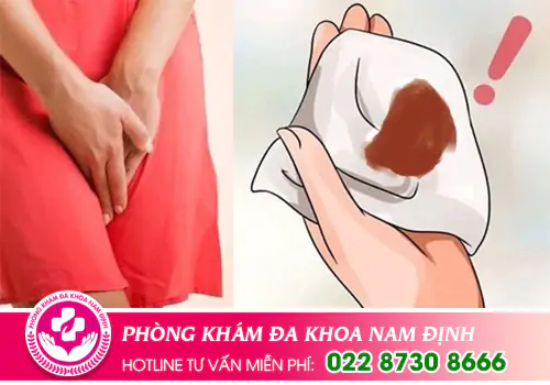 Trễ kinh ra dịch màu nâu có sao không?