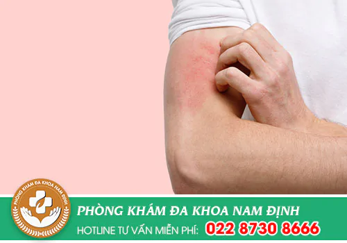 Nhận biết các triệu chứng giang mai qua từng giai đoạn