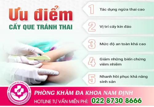 Ưu nhược điểm của cấy que tranh thai