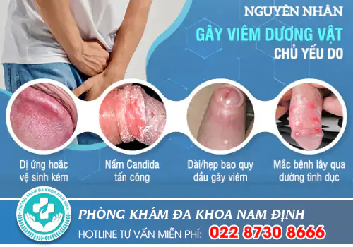viêm dương vật