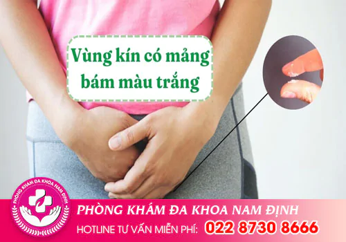 Bên trong vùng kín có mảng bám màu trắng là dấu hiệu cảnh báo bệnh gì?