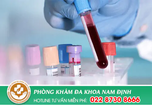 Địa chỉ xét nghiệm sùi mào gà uy tín, kết quả nhanh tại Nam Định